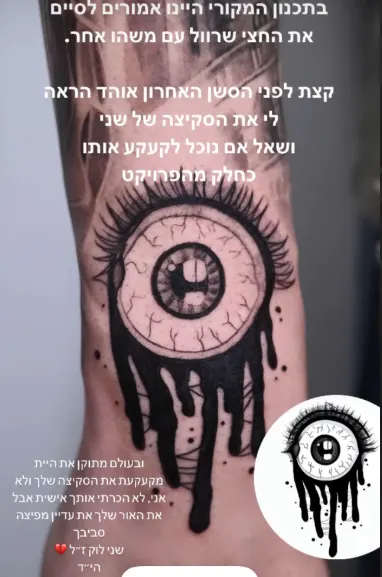 eye